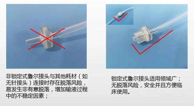 輸液器魯爾鎖